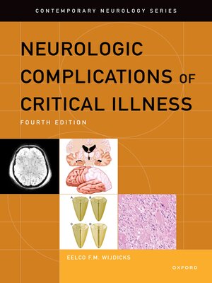 cover image of Neurologic Complications of Critical Illness